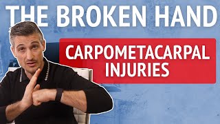 The Broken Hand 2 Carpometacarpal CMC Injuries and bossing in combat sports [upl. by Nohs]