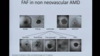 Fundus Autofluorescence [upl. by Scottie]