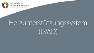 Herzunterstützungssystem LVAD  Infofilme zur HerzOP  RHÖNKLINIKUM Campus Bad Neustadt [upl. by Sabec952]