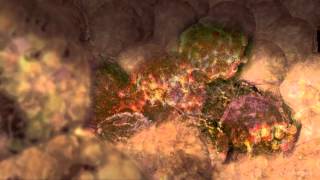 Cancer Cells Undergoing Mitosis [upl. by True]