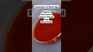 Blood agar microscope infection drmicro [upl. by Eened]