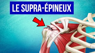 Tendinite du supra épineux à lépaule  Explication et Traitement [upl. by Ahsia37]