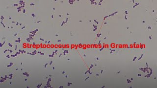 Streptococcus pyogenes in Gram stained smear of culture Microscopy at various magnifications [upl. by Ylrebmi19]