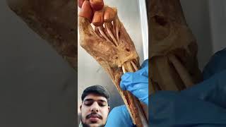 Tugging on a Real Human Thumb Tendon [upl. by Pozzy]