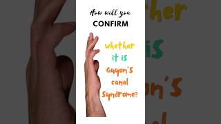 Confirmatory test for Guyon’s canal syndrome Froment’s test Ulnar tunnel syndrome shorts [upl. by Grand]