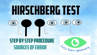 Hirschberg corneal reflex test [upl. by Sopher331]