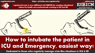 How to intubate the patient in ICU and Emergency easiest way  RegularCrisis [upl. by Zurciram]