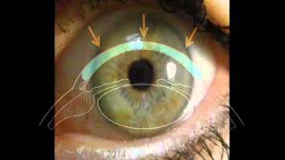 Cornea 1 A Remarkable Structure [upl. by Hamfurd]