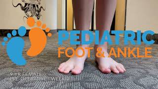 9 Year Old Girls Toe Walking Journey to Recovery with Dr Jarman [upl. by Enirehtac]