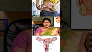 Fibroid கட்டி வர முக்கிய காரணம் இதுதான் 😳 [upl. by Ayiotal]