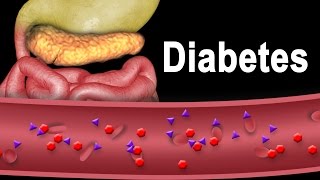 Diabetes Type 1 and Type 2 Animation [upl. by Blessington]