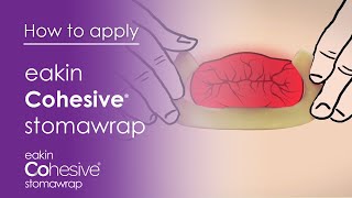 How to apply Cohesive StomaWrap™ [upl. by Yenalem]