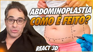 ABDOMINOPLASTIA APÓS A GRAVIDEZ DESCUBRA COMO ESSE PROCEDIMENTO PODE TE AJUDAR [upl. by Sion117]