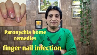 Paronychia home remedies I finger nail infection I skin infection [upl. by Kezer123]