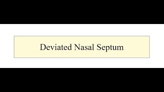 Deviated Nasal septum [upl. by Sylado]