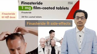 Finasteride Side effects  Finasteride का सही dose Finasteride results  Finasteride tablets ip 1mg [upl. by Oisinoid]