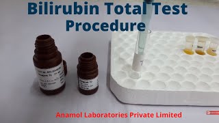 Bilirubin Test Procedure  Bilirubin Total Test [upl. by Dottie899]