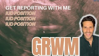 GRWM  Get Reporting with Me  IUD Position [upl. by Ahsekim]