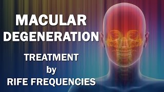 Macular Degeneration  RIFE Frequencies Treatment  Energy amp Quantum Medicine with Bioresonance [upl. by Occir]