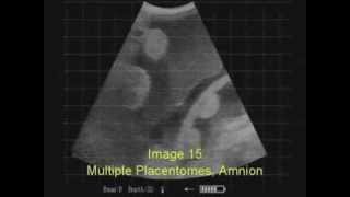 Ultrasound Pregnancy Testing 3rd Trimester Cows with ReproScan XTC [upl. by Stoddard212]