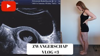 EERSTE ECHO amp MISSELIJK  6 7 amp 8 weken  ZWANGERSCHAP VLOG 3 [upl. by Adyahs4]