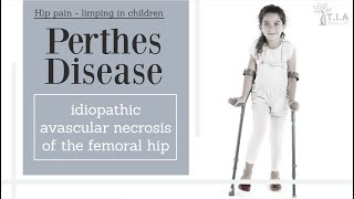 Perthes Disease LeggCalvePerthes Disease  nonsurgical treatment [upl. by Namhcan949]