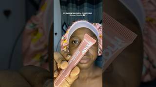 Hyperpigmentation treatment skincare routine ✨🌸 [upl. by Aliehc]