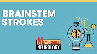 Brainstem Stroke Mnemonics Memorable Neurology Lecture 15 [upl. by Rebmetpes]