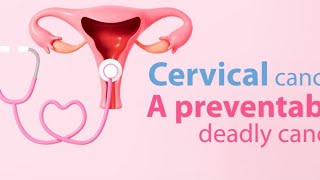 cervical cancer Professionalnurse698 [upl. by Mathilda999]