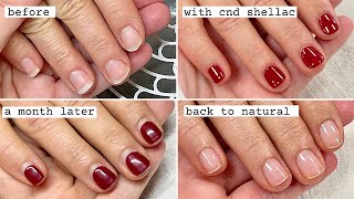 Gentle Shellac Removal and Manicure How nail shape can change after polish wear [upl. by Arhez810]