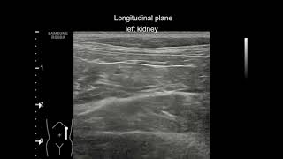 Hydronephrosis in a cat [upl. by Horwath]