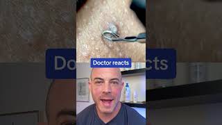 Derm reacts to infected ingrown hair dermreacts ingrownhair [upl. by Assilym]