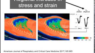 2 Determinants of respiratory drive Georgopoulos Dimitrios ARF18 [upl. by Aker]