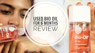 Bio Oil Review  Does Bio Oil Work on Stretch Marks amp Scars  SuperWowStyle [upl. by Pasia457]