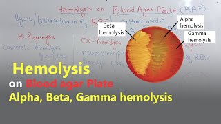 Hemolysis on Blood Agar plate  BAP  β hemolysis α hemolysis γhemolysis [upl. by Aital319]