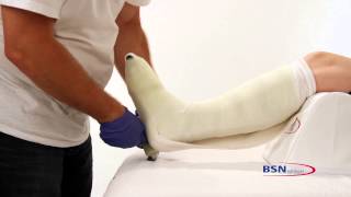 Application technique of Cutimed Total Contact Cast [upl. by Atineb]