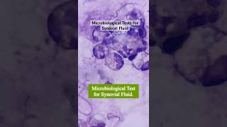 Microbiological Tests on Synovial Fluid medtech medtechstudent shortvideos synovialfluid fypシ゚ [upl. by Nicko]