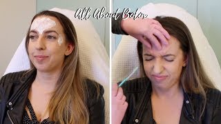 All About Botox 💉 Crows Feet Forehead 11 Before amp After Photos Does It Work Cost Review [upl. by Eenot]