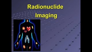 Application of Radionuclide Scanning for Diagnosis of musculoskeletal system disease [upl. by Llertniuq656]