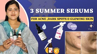 3 Best Summer Serums  For Oily  Acne Prone Skin  Summer Skincare ☀️  Dr Arwa Bohra [upl. by Kila128]