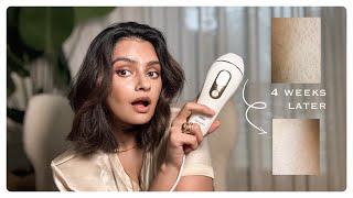 IPL Hair Removal At Home with Braun What I think 15 years later [upl. by Dyanne346]