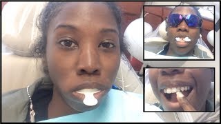 NEW TEETH  My Dental Bridge Journey Part 1 [upl. by Saidel]