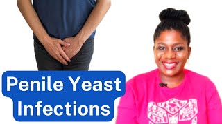 How To Treat A Male Yeast Infection Causes Symptoms And Treatment For Penile Thrush [upl. by Aeslek233]