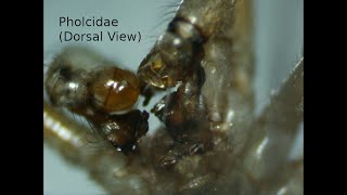 Cellar Spider Pholcidae  Dorsal View under Dissecting Microscope [upl. by Arihat]