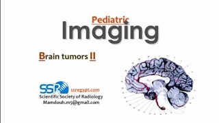 Pediatric imaging Brain tumors II DRE Prof Mamdouh Mahfouz [upl. by Augusta]