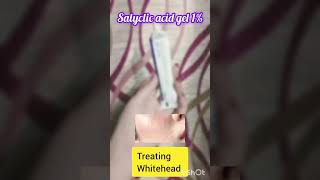 salyclic acid gel 1 best for beginners acnetreatment whiteheadremoval blackheads [upl. by Gnagflow103]