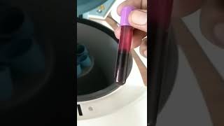 Centrifuge machine plasma separation of blood [upl. by Monto]