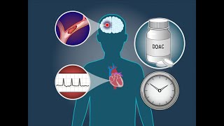 Anticoagulation Timing after Stroke in Atrial Fibrillation  NEJM [upl. by Dimah382]