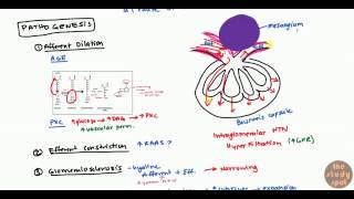 Diabetic Nephropathy for USMLE Step1 and USMLE Step 2 [upl. by Marcella]