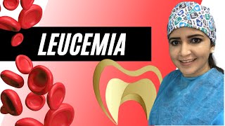 LEUCEMIA y el tratamiento dental  SOY DENTISTA SoyDentista [upl. by Anivlac]